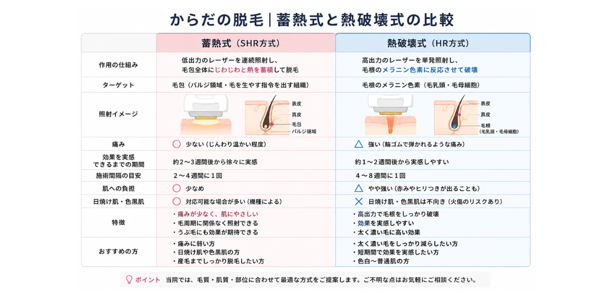 蓄熱式(SHR)とは — 従来の脱毛との違い